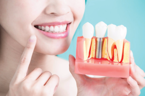 our services dental implants Kitchener Periodontal Dental Centre Dentist Periodontist